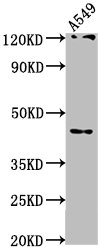 Immunofluorescence staining of HepG2 cells with CAC15803 at 1:50, counter-stained with DAPI. The cells were fixed in 4% formaldehyde, permeabilized using 0.2% Triton X-100 and blocked in 10% normal Goat Serum. The cells were then incubated with the antibody overnight at 4°C. The secondary antibody was Alexa Fluor 488-congugated AffiniPure Goat Anti-Rabbit IgG(H+L).