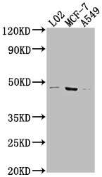 USP17L6P Polyclonal Antibody - image 2