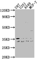 ATP6V1D Polyclonal Antibody - image 2