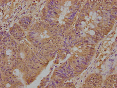 Immunofluorescence staining of Hela cells with CAC15839 at 1:100, counter-stained with DAPI. The cells were fixed in 4% formaldehyde, permeabilized using 0.2% Triton X-100 and blocked in 10% normal Goat Serum. The cells were then incubated with the antibody overnight at 4°C. The secondary antibody was Alexa Fluor 488-congugated AffiniPure Goat Anti-Rabbit IgG(H+L).