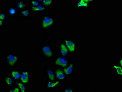 TNFRSF1A Polyclonal Antibody - image 4