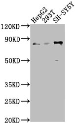Uncharacterized protein Polyclonal Antibody - image 2