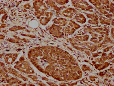 CDK17 Polyclonal Antibody - image 3
