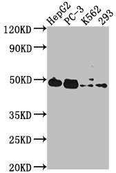 IHC image of CAC15850 diluted at 1:300 and staining in paraffin-embedded human kidney tissue performed on a Leica BondTM system. After dewaxing and hydration, antigen retrieval was mediated by high pressure in a citrate buffer (pH 6.0). Section was blocked with 10% normal goat serum 30min at RT. Then primary antibody (1% BSA) was incubated at 4°C overnight. The primary is detected by a biotinylated secondary antibody and visualized using an HRP conjugated SP system.