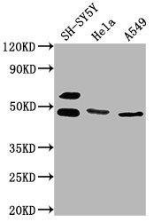 ANGPTL4 Polyclonal Antibody - image 2