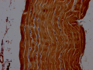 ACTN2 Polyclonal Antibody - image 3