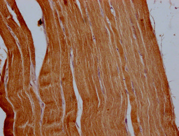 ACTN2 Polyclonal Antibody - image 3