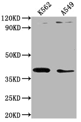 TMOD1 Polyclonal Antibody - image 2