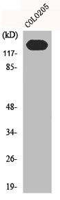 Western Blot analysis of Jurkat cells using N-cadherin Polyclonal Antibody