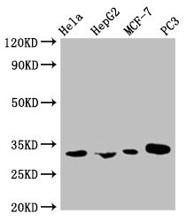 AGBL2 Monoclonal Antibody - image 2