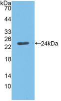 Angiopoietin Like Protein 8 (ANGPTL8) Polyclonal Antibody - image 2