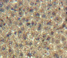 Angiopoietin Like Protein 8 (ANGPTL8) Polyclonal Antibody - image 3