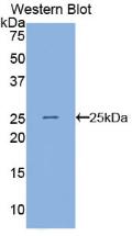 Angiopoietin Like Protein 8 (ANGPTL8) Polyclonal Antibody - image 2