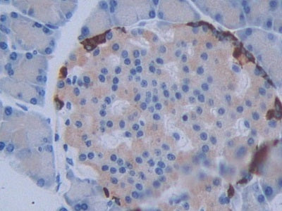 DAB staining on fromalin fixed paraffin- embedded Kidney tissue)