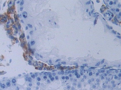 Methyltransferase Like Protein 21C (METTL21C) Polyclonal Antibody - image 4
