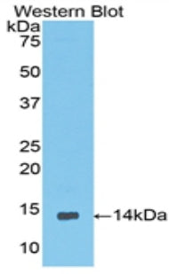 Coiled Coil Domain Containing Protein 60 (CCDC60) Polyclonal Antibody - image 2