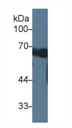 Coiled Coil Domain Containing Protein 60 (CCDC60) Polyclonal Antibody - image 2