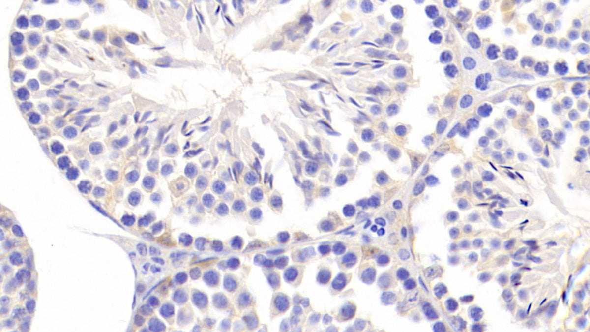 Coiled Coil Domain Containing Protein 60 (CCDC60) Polyclonal Antibody - image 4