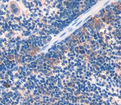 Dynein Heavy Chain Domain Containing Protein 1 (DNHD1) Polyclonal Antibody - image 3