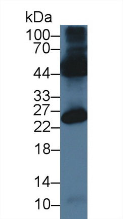 Occludin/ELL Domain Containing Protein 1 (OCEL1) Polyclonal Antibody - image 2