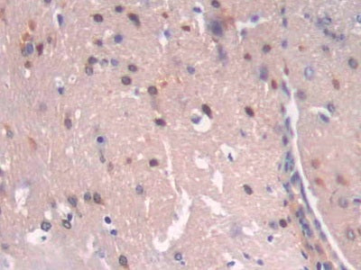 DAB staining on IHC-P; Samples: Mouse Oviduct Tissue.