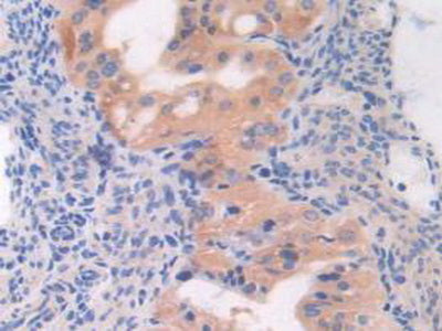 Mab21 Domain Containing Protein 1 (MB21D1) Polyclonal Antibody - image 5