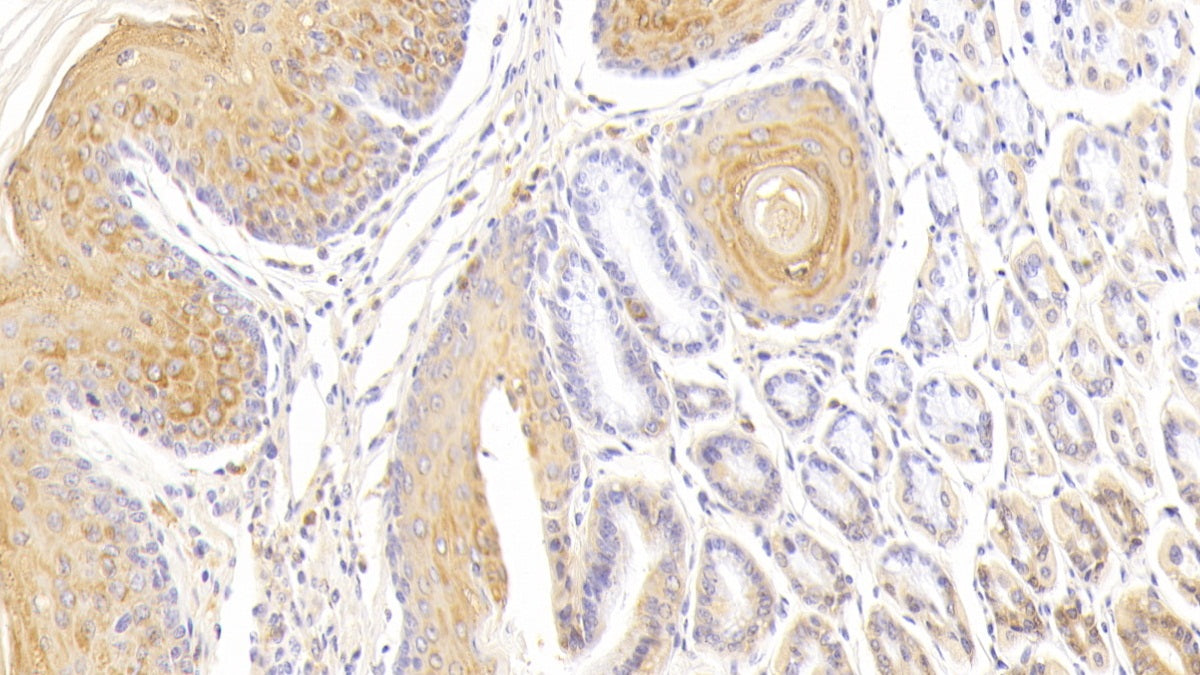 DAB staining on fromalin fixed paraffin- embedded Kidney tissue)