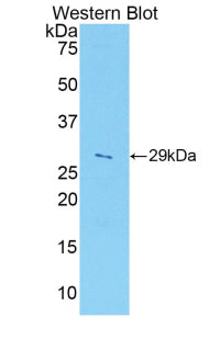 A Disintegrin And Metalloprotease 5 (ADAM5) Polyclonal Antibody - image 2