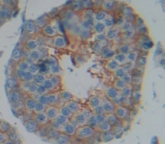 A Disintegrin And Metalloprotease 5 (ADAM5) Polyclonal Antibody - image 3