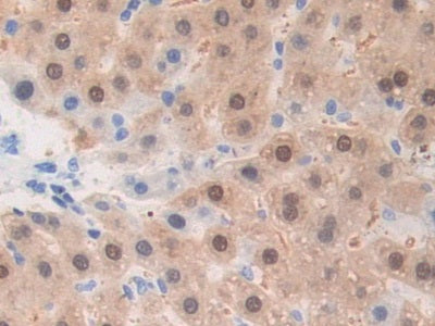DAB staining on fromalin fixed paraffin- embedded Kidney tissue)