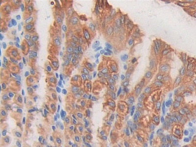 A Disintegrin And Metalloprotease 1 (ADAM1) Polyclonal Antibody - image 4