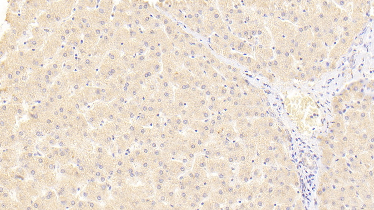 Vascular Endothelial Growth Factor 145 (VEGF145) Polyclonal Antibody - image 3