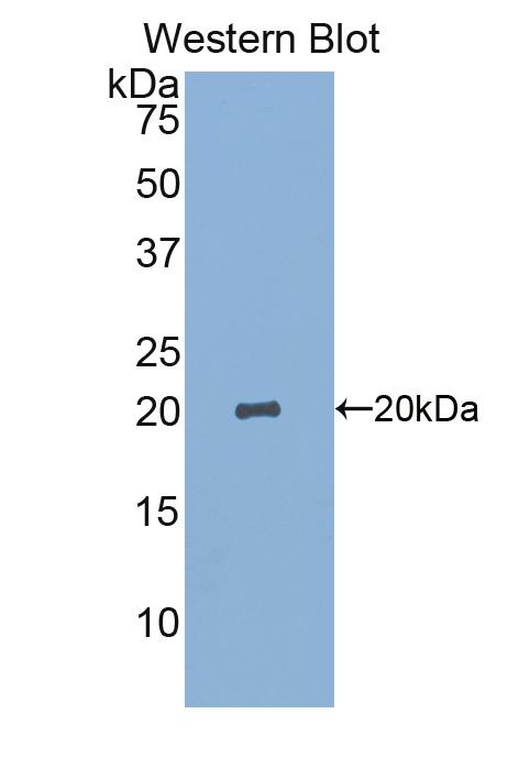 DAB staining on IHC-P; Samples: Human Cerebrum Tissue;  Primary Ab: 20μg/ml Rabbit Anti-Human SIGLEC14 Antibody Second Ab: 2µg/mL HRP-Linked Caprine Anti-Rabbit IgG Polyclonal Antibody