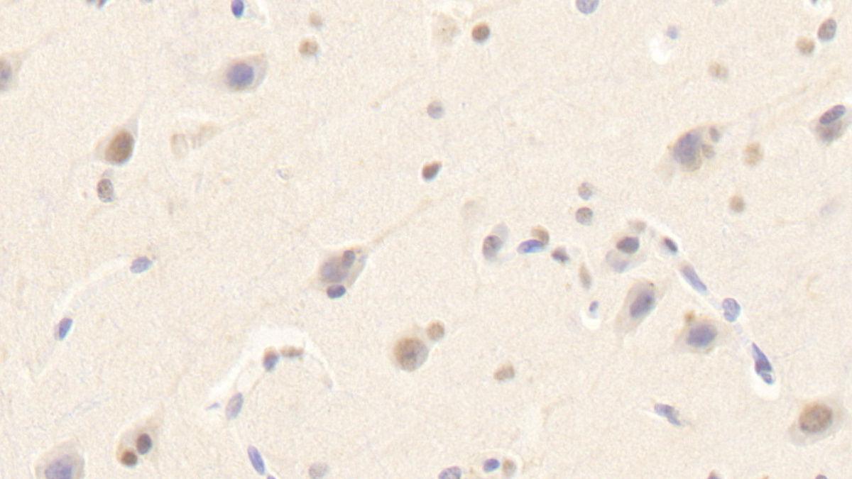 Sialic Acid Binding Ig Like Lectin 14 (SIGLEC14) Polyclonal Antibody - image 4