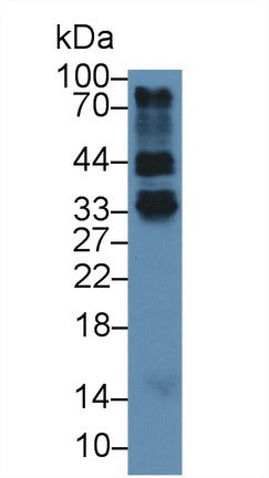 Western Blot; Sample: Recombinant protein.