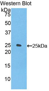 DAB staining on IHC-P; Samples: Mouse Lung Tissue;  Primary Ab: 10µg/ml Rabbit Anti-Mouse FOLR4 Anti