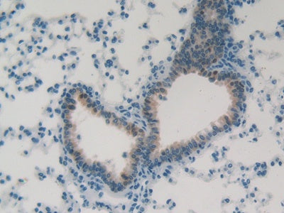 Folate Receptor 4 (FOLR4) Polyclonal Antibody - image 5