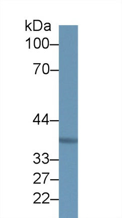 Western Blot; Sample: Recombinant protein.