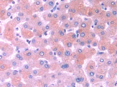 DAB staining on fromalin fixed paraffin- embedded liver tissue)