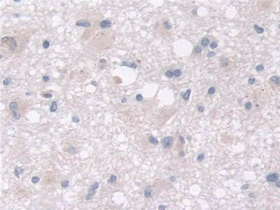 MOCO Sulphurase C-Terminal Domain Containing Protein 1 (MOSC1) Polyclonal Antibody - image 5