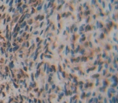 Ly1 Antibody Reactive Homolog (LYAR) Polyclonal Antibody - image 4