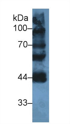 Western Blot; Sample: Recombinant protein.