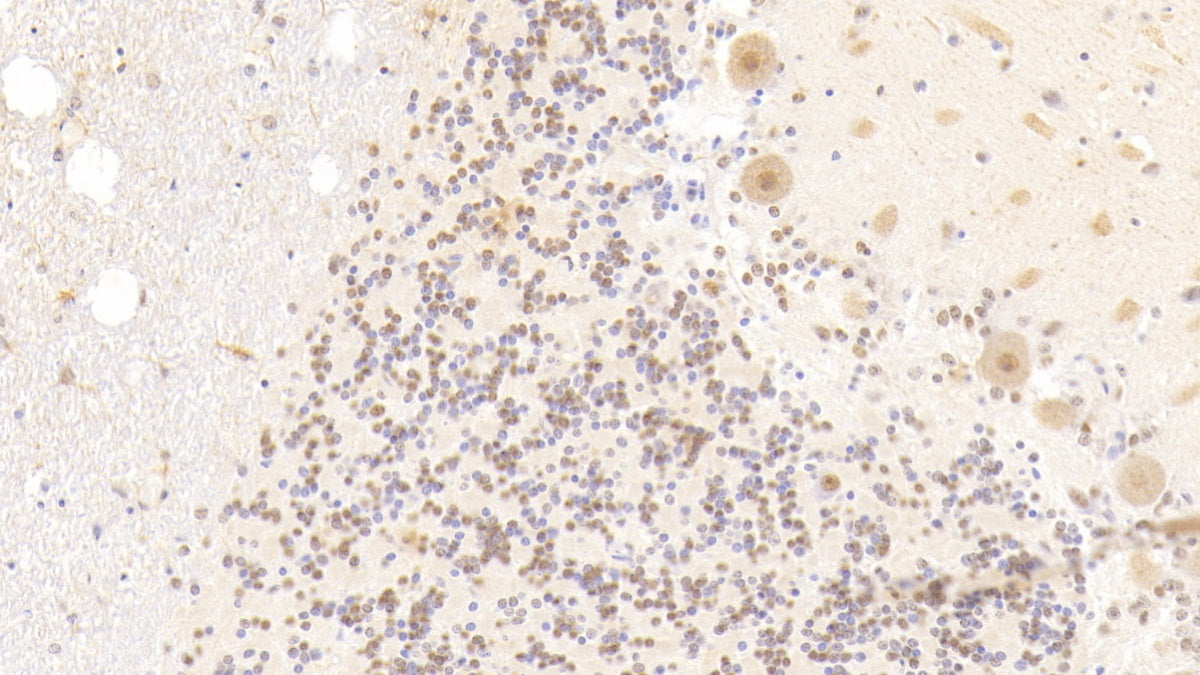 Ly1 Antibody Reactive Homolog (LYAR) Polyclonal Antibody - image 4