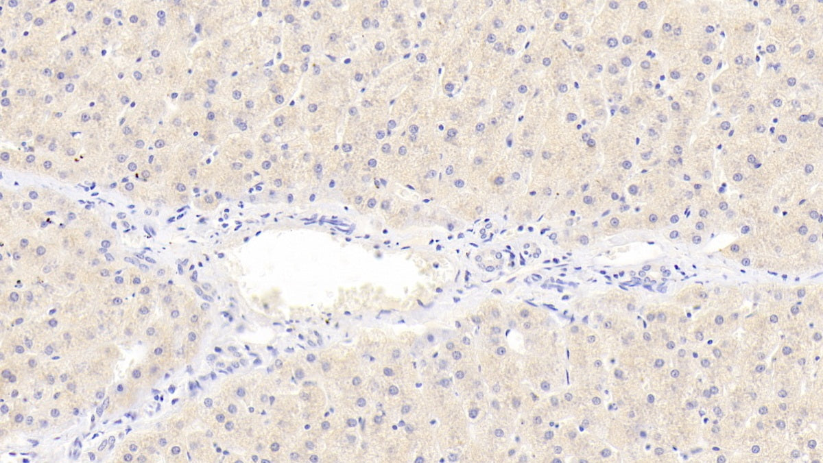 DABstainingonIHC-P.Samples:HumanTissue)