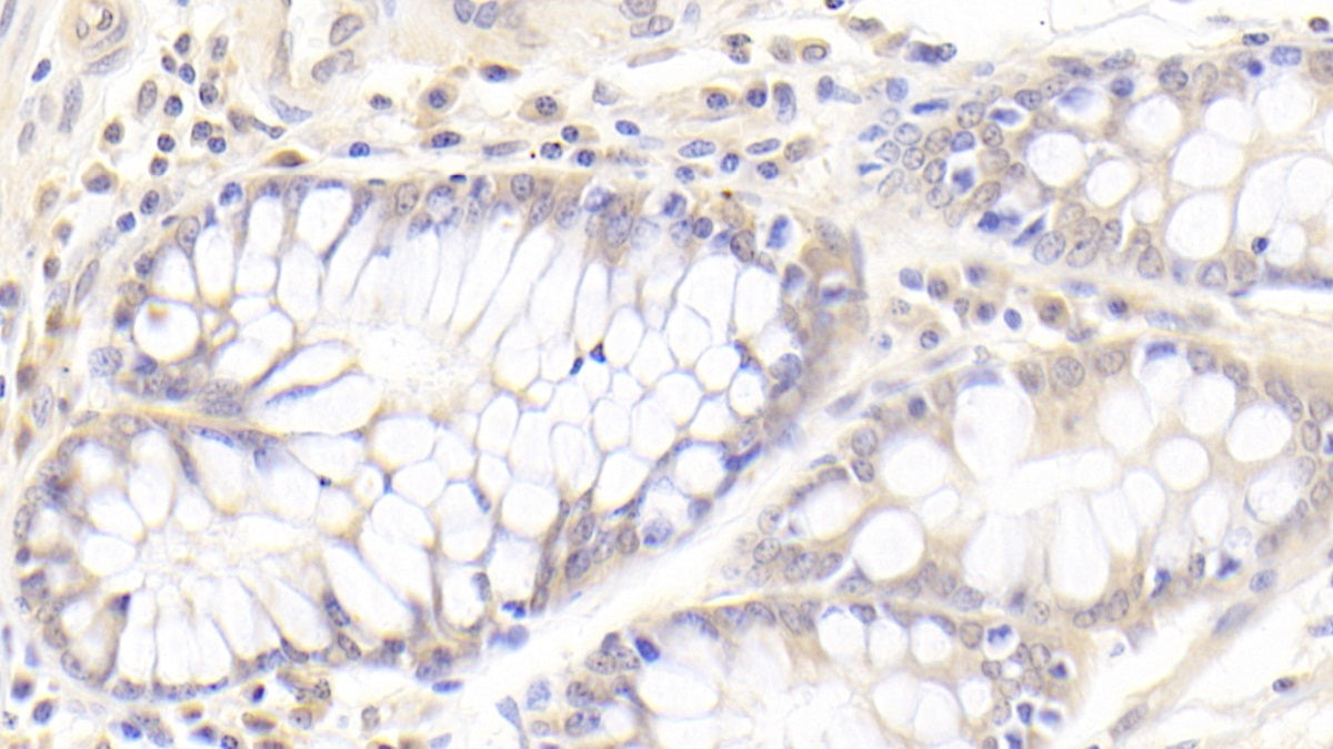 Coenzyme Q10 Homolog B (COQ10B) Polyclonal Antibody - image 4