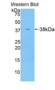Angiopoietin Like Protein 7 (ANGPTL7) Polyclonal Antibody - image 2