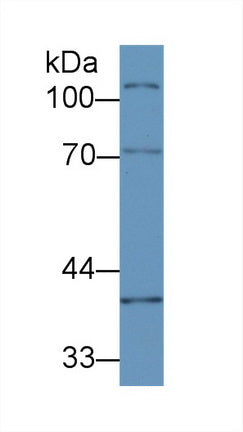 Western Blot; Sample: Recombinant protein.