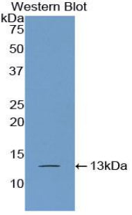 Poly A Binding Protein Cytoplasmic 1 Like Protein (PABPC1L) Polyclonal Antibody - image 3
