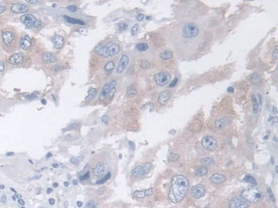 DAB staining on fromalin fixed paraffin- embedded liver tissue)