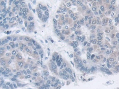 Adipocyte Plasma Membrane Associated Protein (APMAP) Polyclonal Antibody - image 5